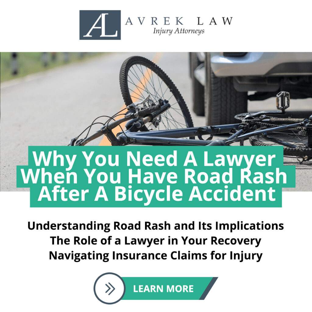 Featured image for Why You Need A Lawyer When You Have Road Rash After A Bicycle Accident